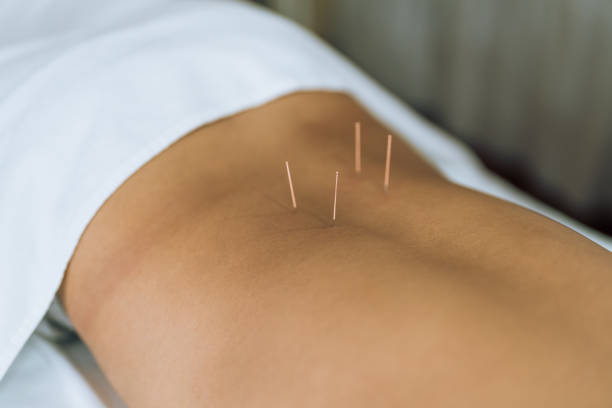 acupuncteur à Bourgoin-Jallieu